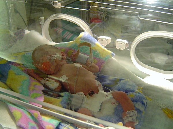Hospital Pics 11-12-03 001.jpg
